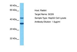 SCD5 Rabbit anti-Human, Polyclonal, Novus Biologicals 0.1 mL | Buy Online | Novus Biologicals | Fisher Scientific